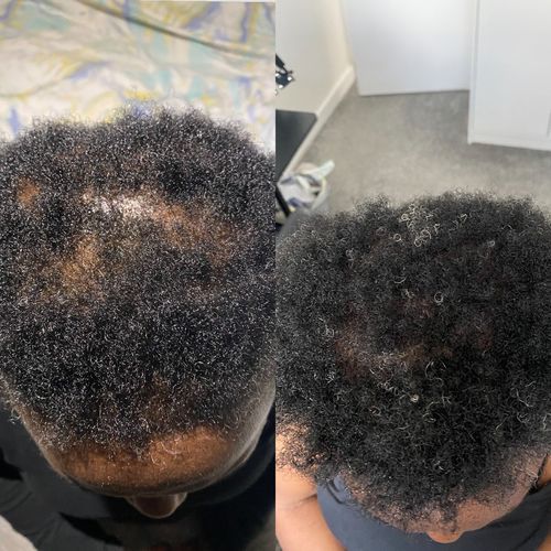 Customer photo review of Inches - Ayurvedic Hair & Beard Growth Oil