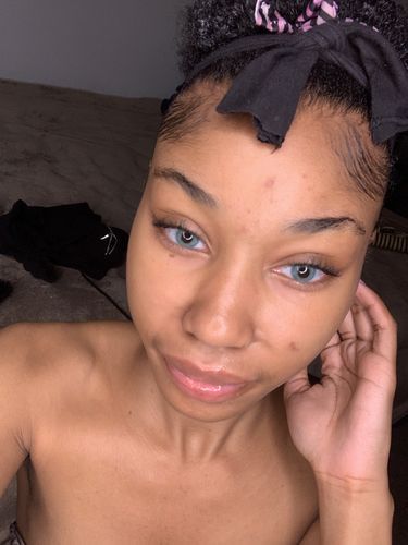 Customer photo review of Cherry Sky Blue Coloured Contact Lenses