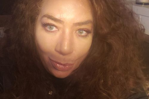 Customer photo review of Cherry Sky Blue Coloured Contact Lenses