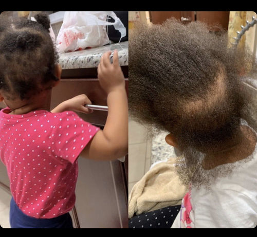 Customer photo review of PureFix Hair Elixir