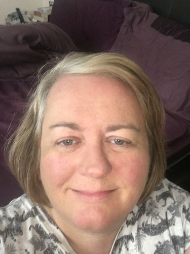 Customer photo review of Rosalique 3 in 1 Anti-Redness Miracle Formula SPF50