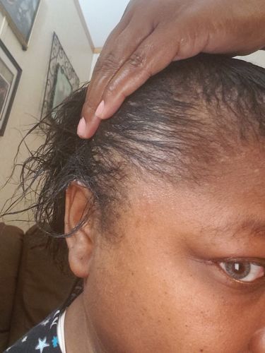 Customer photo review of Nae Nae's Hair Boost 9oz