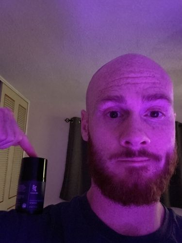 Customer photo review of CBD Sports Cream (Bundle version)
