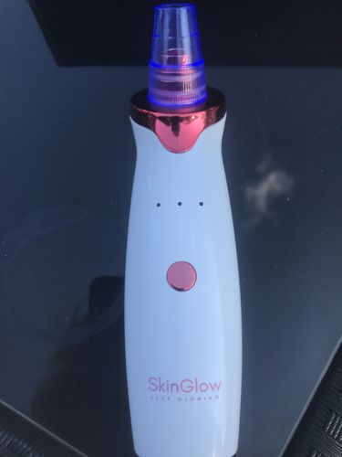 Customer photo review of SkinGlow Electric Cleanser - No More Blackheads