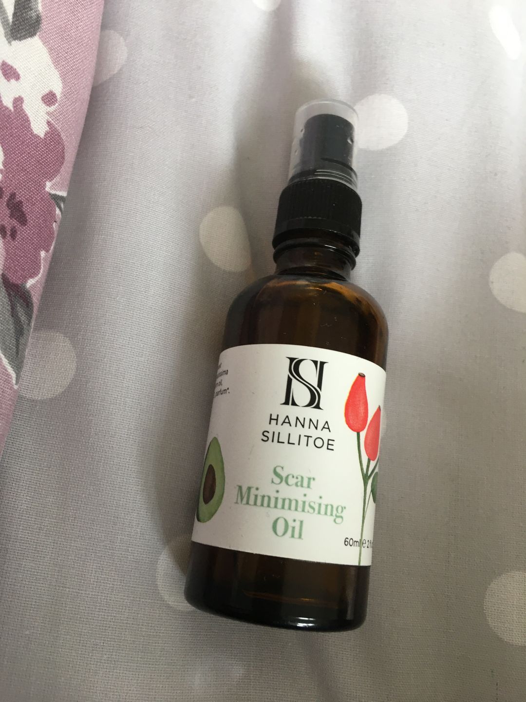 Customer photo review of Scar Minimising Oil