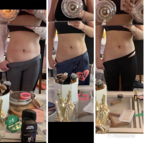 Customer photo review of CavitatUltra™️ - 3 in 1 Fat & Cellulite Remover