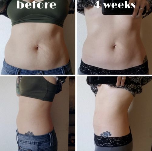 Customer photo review of CavitatUltra™️ - 3 in 1 Fat & Cellulite Remover