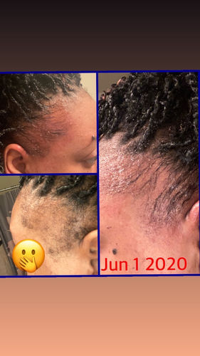 Customer photo review of PureFix Hair Elixir