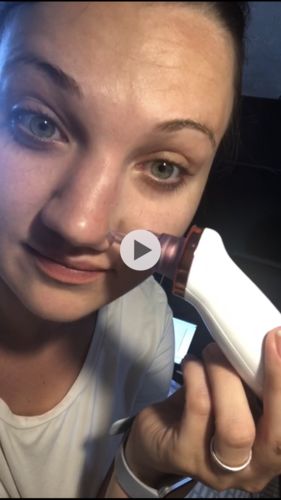 Customer photo review of SkinGlow Electric Cleanser - No More Blackheads
