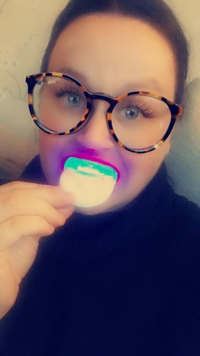 Customer photo review of Teeth Whitening Kit