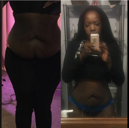 Customer photo review of CavitatUltra™️ - 3 in 1 Fat & Cellulite Remover