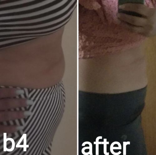 Customer photo review of CavitatUltra™️ - 3 in 1 Fat & Cellulite Remover