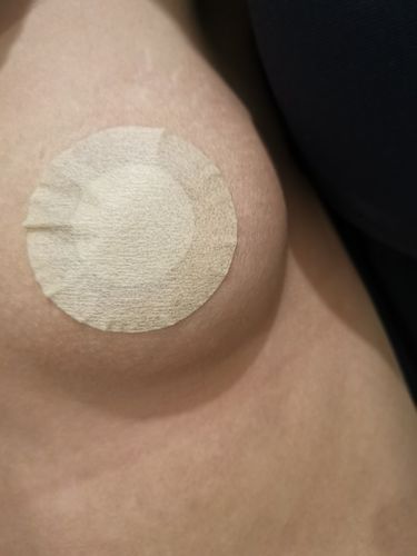 Customer photo review of Invisible Nipple Covers
