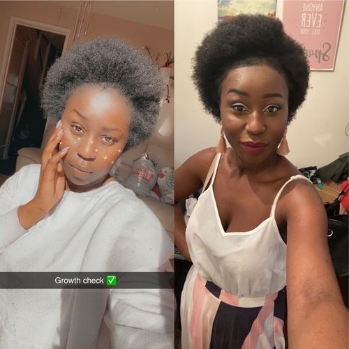 Customer photo review of Inches - Ayurvedic Hair & Beard Growth Oil