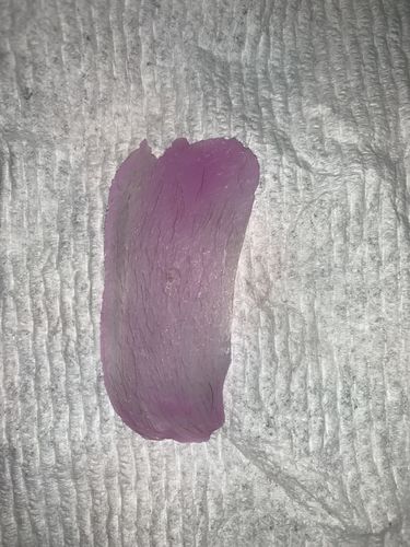 Customer photo review of Signature Series Hair Removal Wax