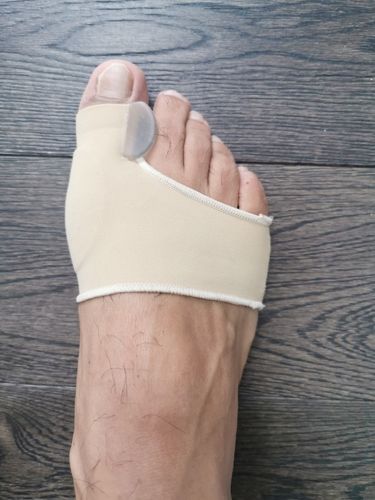Customer photo review of NovaBunion™ Orthopedic Corrector Sleeve (1 pair)