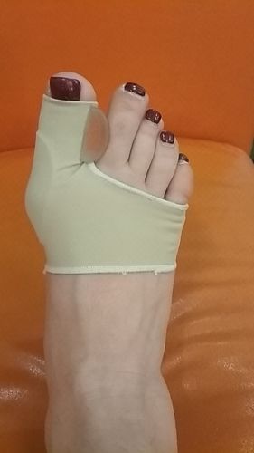 Customer photo review of NovaBunion™ Orthopedic Corrector Sleeve (1 pair)