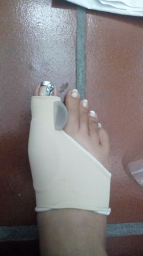 Customer photo review of NovaBunion™ Orthopedic Corrector Sleeve (1 pair)