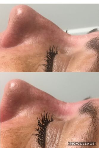 Customer photo review of Scalpa HyaInfuse