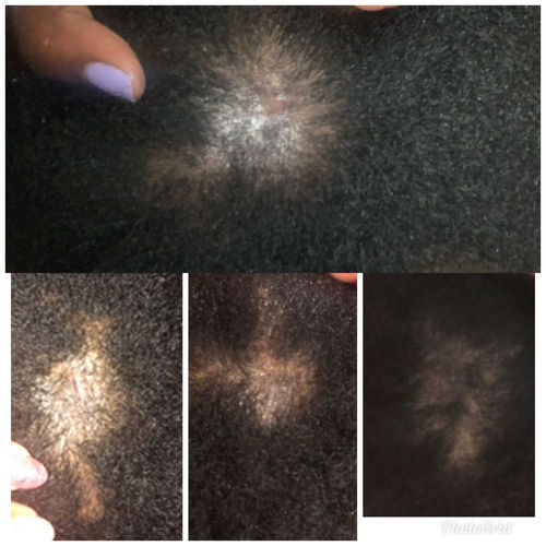 Customer photo review of Nae Nae's Hair Boost 9oz