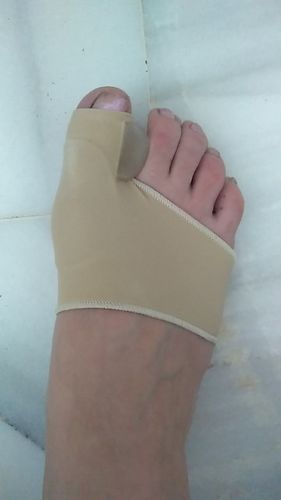 Customer photo review of NovaBunion™ Orthopedic Corrector Sleeve (1 pair)