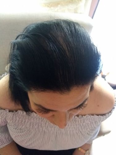 Customer photo review of Fenice Shampoo