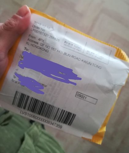 Customer photo review of NovaBunion™ Orthopedic Corrector Sleeve (1 pair)