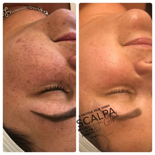 Customer photo review of MesoBright Serum