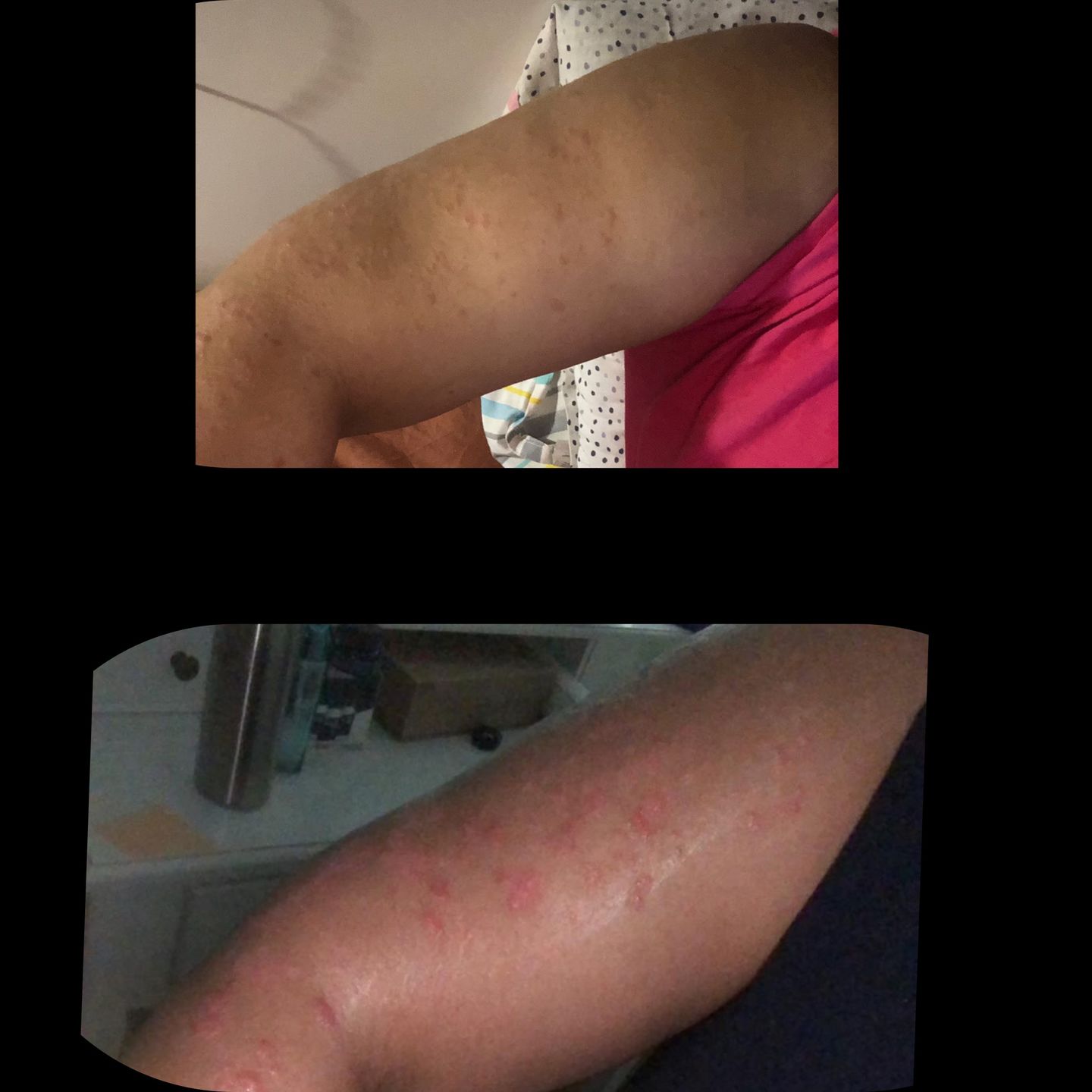 Customer photo review of Milk Thistle Tincture