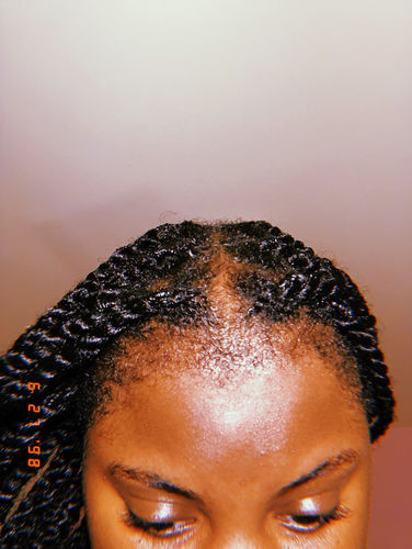 Customer photo review of Flower Bomb Hair Growth Oil