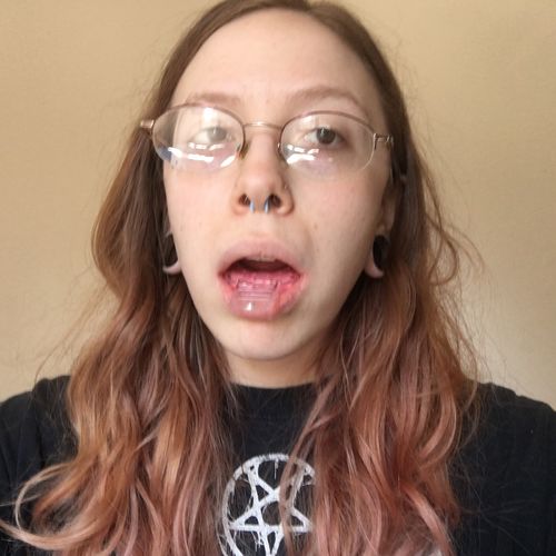 Customer photo review of Night Guard