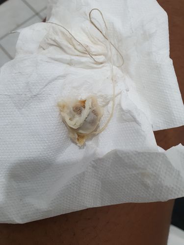 Customer photo review of Perle de Detox Vaginale (Lot de 3 perles par sachet)