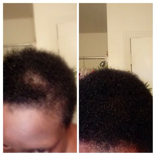 Customer photo review of PureFix Hair Elixir