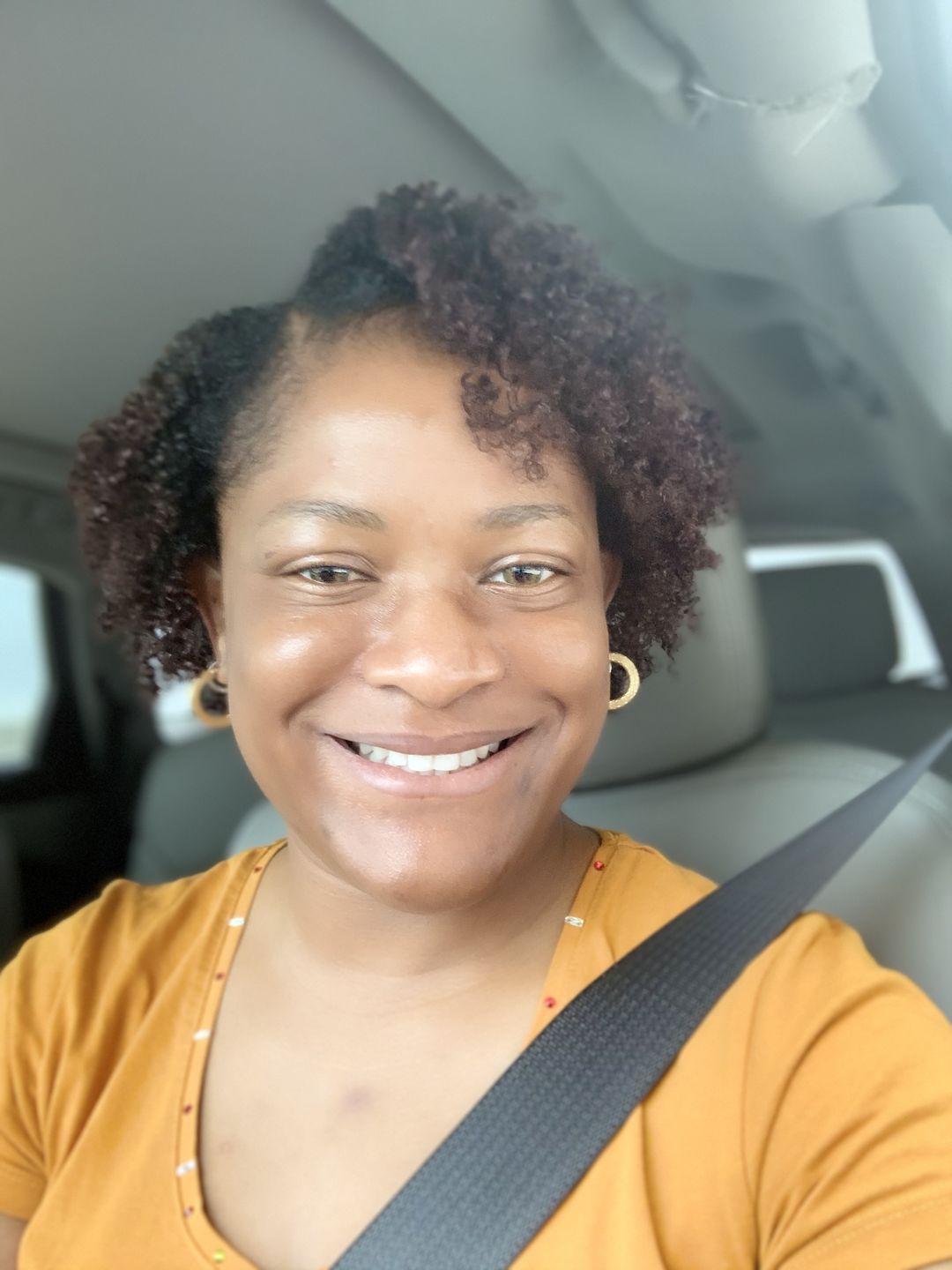 Customer photo review of Bolden Clear Skin Kit