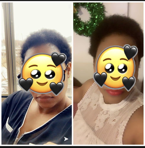 Customer photo review of Nae Nae's 9oz Hair Boost Special