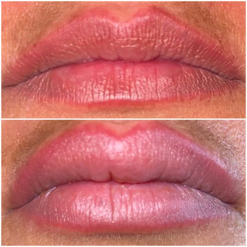 Customer photo review of LIP BOOSTING SYSTEM
