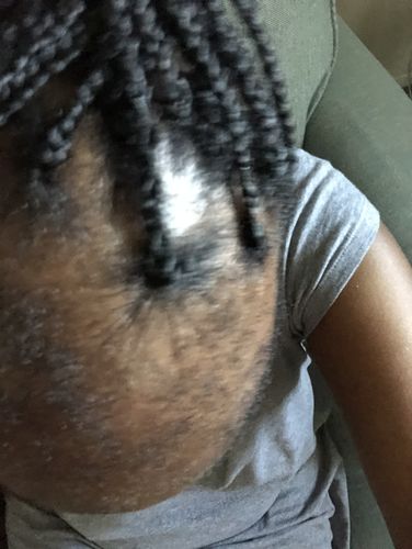 Customer photo review of Nae Nae's Hair Boost 9oz
