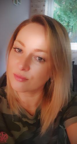 Customer photo review of SkinGlow Electric Cleanser - No More Blackheads
