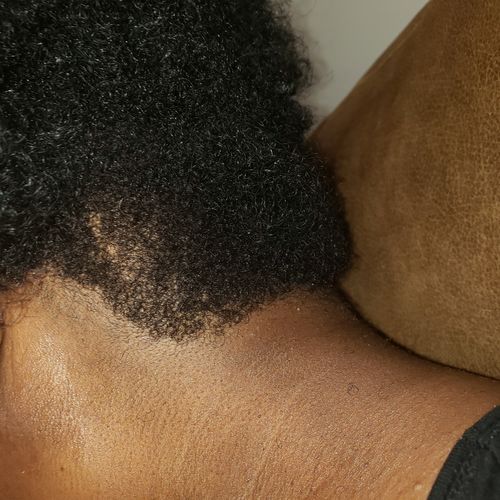 Customer photo review of BEST SELLER (REGROWTH) Hair Serum Extra Strength 1oz