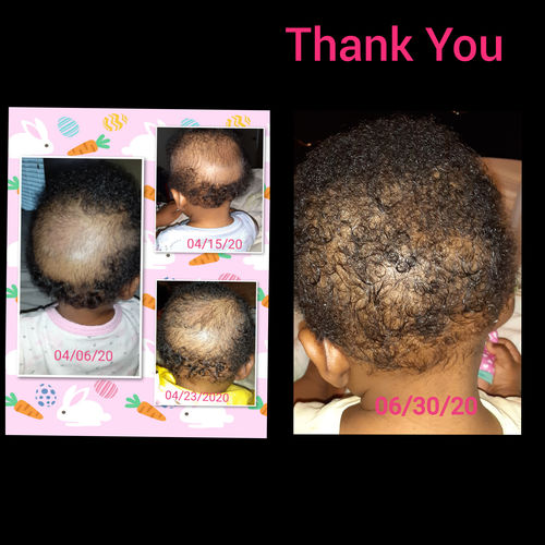 Customer photo review of Fro Butter with Jamaican Black Castor Oil - Hair Thickener