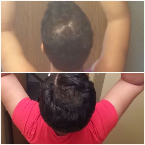 Customer photo review of Nae Nae's Hair Boost 9oz