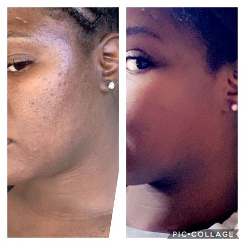 Customer photo review of Turmeric Soap