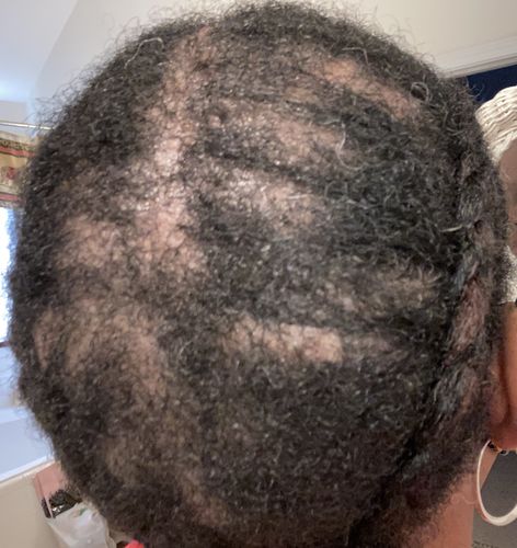 Customer photo review of Nae Nae's Hair Boost 9oz