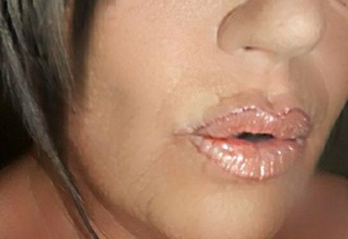 Customer photo review of LIP BOOSTING SERUM