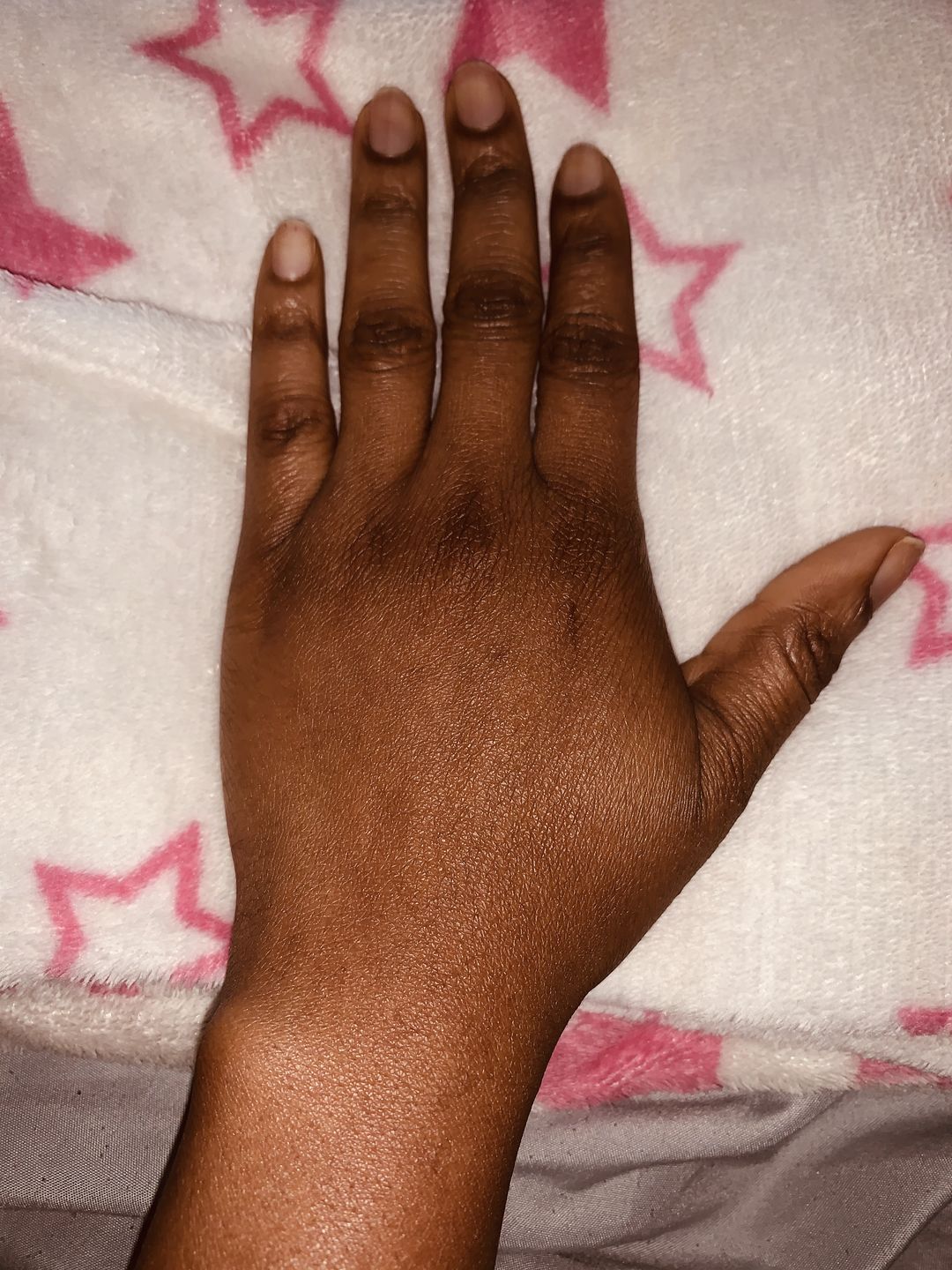 Customer photo review of Fair and White Original Body Clearing Milk Lotion 500 ml / 16.90 fl oz