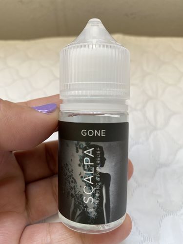Customer photo review of Gone - During Procedure Numbing