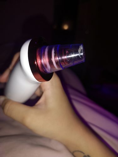 Customer photo review of SkinGlow Electric Cleanser - No More Blackheads