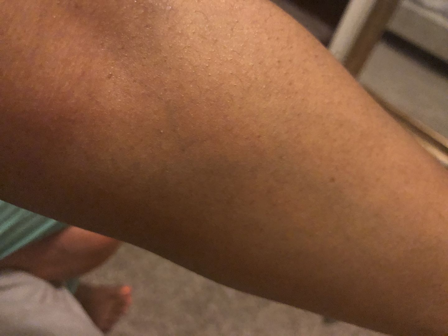 Customer photo review of Omic LightenUp PLUS Active Lightening Cream - 100ml / 3.4 Oz