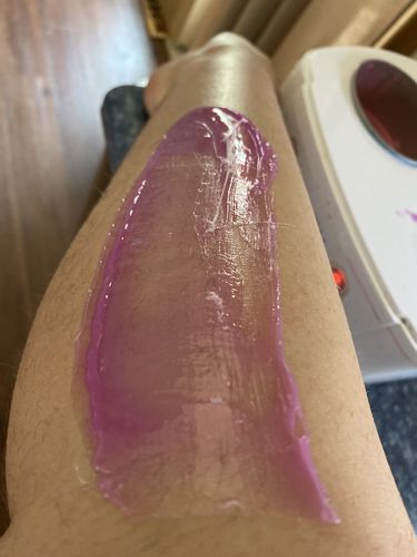 Customer photo review of Signature Series Hair Removal Wax