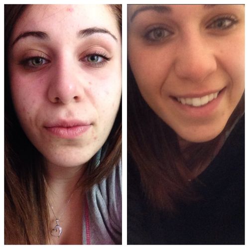 Customer photo review of Morning Cleanse - 28 Day